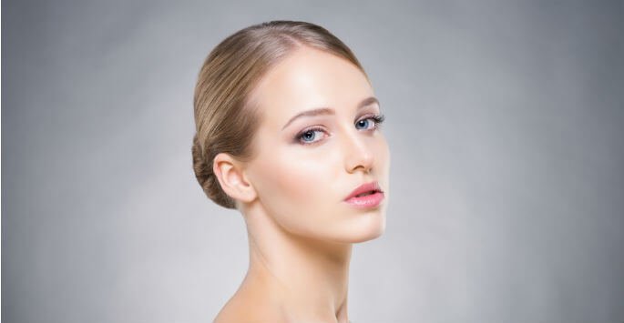 acne scars