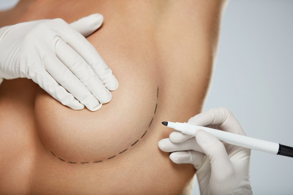 Breast Implants